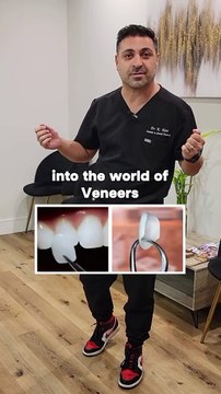 Transform Your Smile with Veneers at Encino Dental Esthetics!
