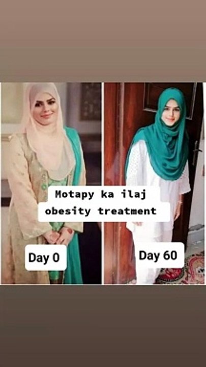 Motapy ka ilaj sirf 60 din k andr obesity treatment no side effects #obesitymedicine #obesity #motapa #viraltiktokvideo #healthtips #pregnancy #viralshort #storytime #shorts #short