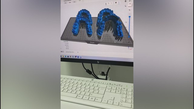 Así se hicieron los brackets especiales de Lamine Yamal para el Clásico