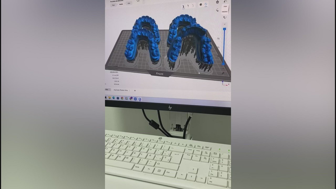 Así se hicieron los brackets especiales de Lamine Yamal para el Clásico