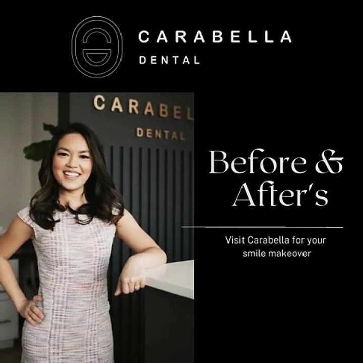 Before and After Smile Transformations