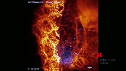 Filmata in 3D la 'danza' delle cellule in un organismo vivente