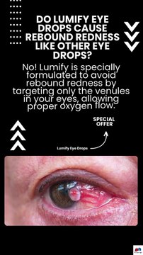 Do Lumify eye drops cause rebound redness like other eye drops