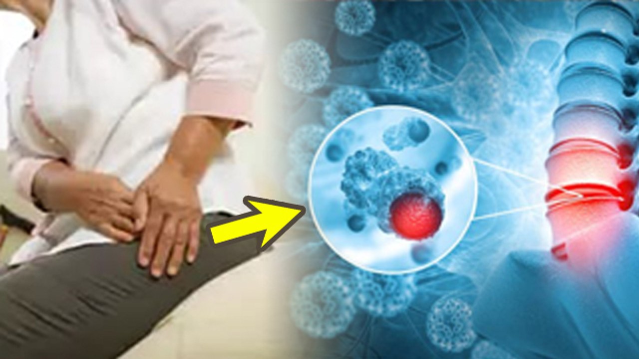 Bone Cancer Causes: Bone Cancer Kyu Aur Kaise Hota Hai, Symptoms In Hindi | Boldsky