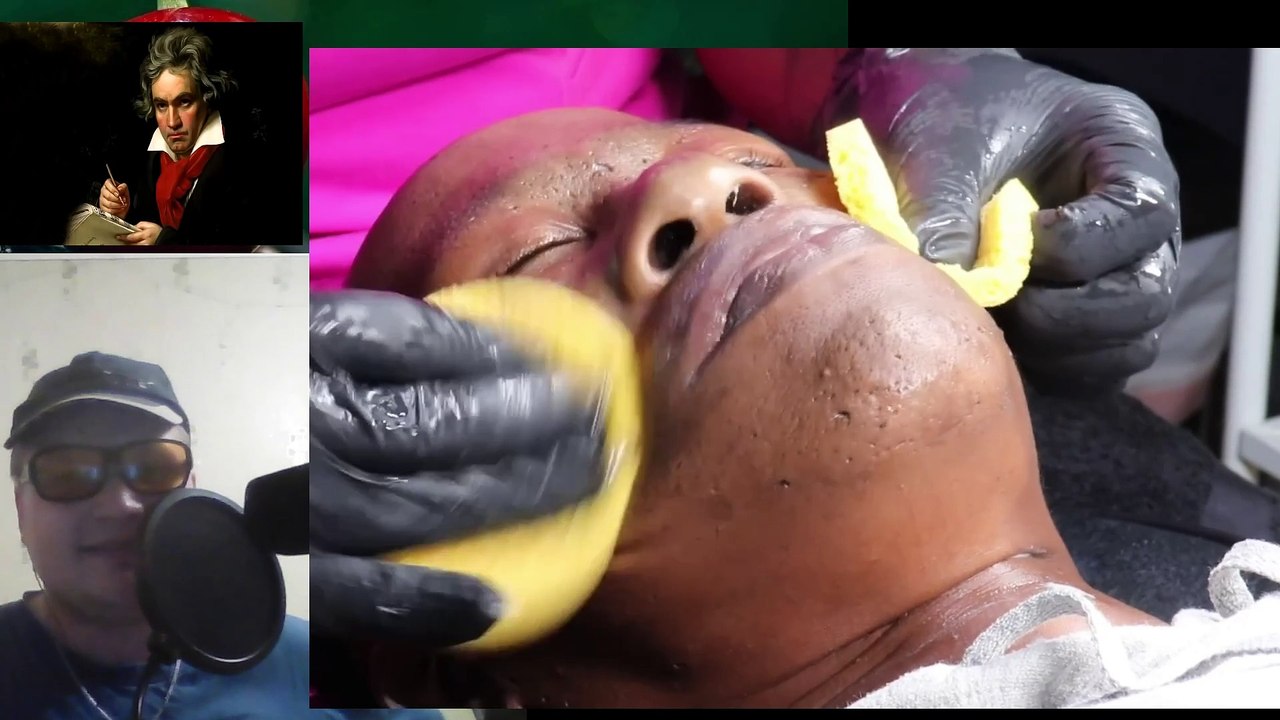 Полная чистка лица от комедонов черных точек или же угрей