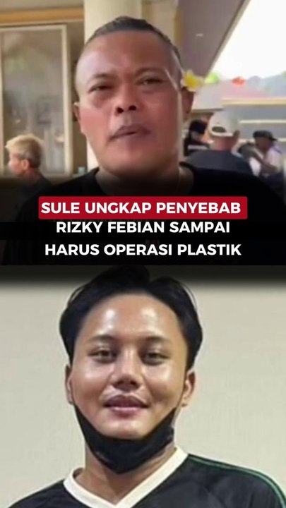 Sule Ungkap Penyebab Rizky Febian Sampai Harus Operasi Plastik