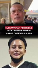 Sule Ungkap Penyebab Rizky Febian Sampai Harus Operasi Plastik