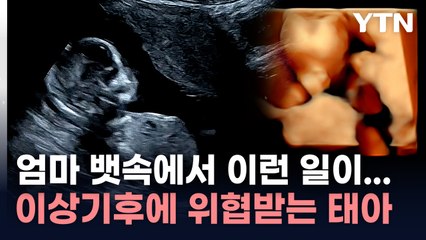 선천적 기형에 조산까지 '치명적'...이상 기후에 목숨 위협받는 아이들 / YTN