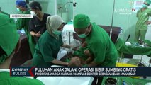 Puluhan Anak Jalani Operasi Bibir Sumbing Gratis