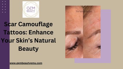 Scar Camouflage Tattoos Enhance Your Skin’s Natural Beauty