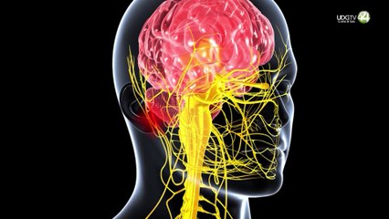 ¿Pierdes fuerza en un brazo o hay insensibilidad en la cara de manera intempestiva? Acude al médico