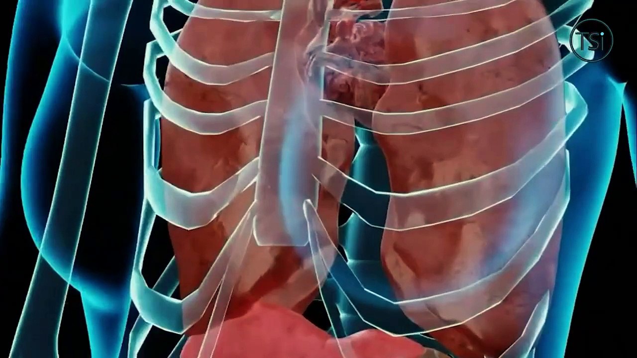 Porque Nos Importa - En Riesgo Pacientes con Trastorno de Tiroides - 29 de octubre 2024