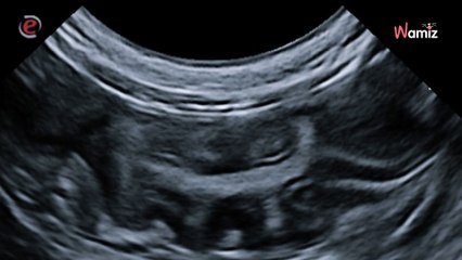 Cette décoration d'Halloween peut être dangereuse pour les chiens et chats, un vétérinaire lance l'alerte