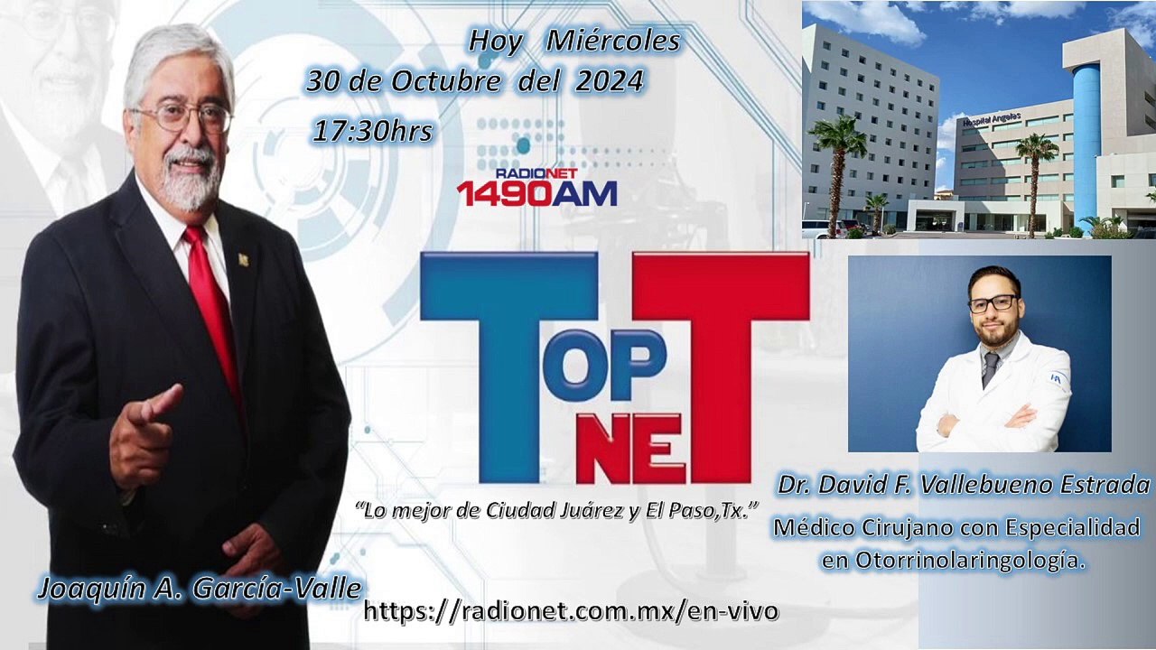 Top Net 30 de octubre 2024