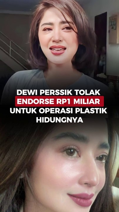 Dewi Perssik Tolak Endorse Rp1 Miliar untuk Operasi Plastik Hidungnya