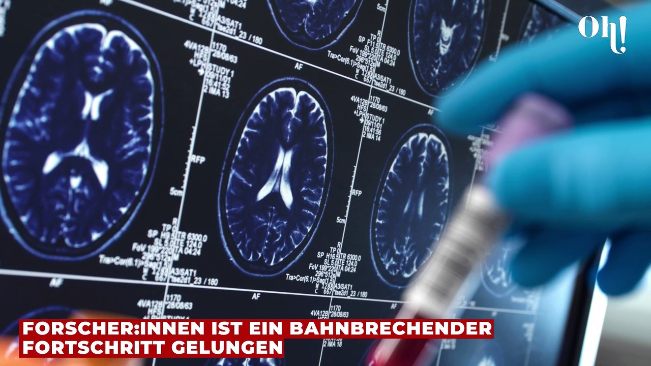 Studie verzeichnet besonderen Durchbruch: Forscher gelingt Wiederbelebung von Schweinen
