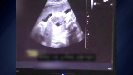 경찰 "36주 태아, 출산 전후 생존 단서 확보" / YTN