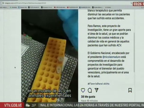 Médicos venezolanos inician investigación científica para disminuir secuelas del ACV