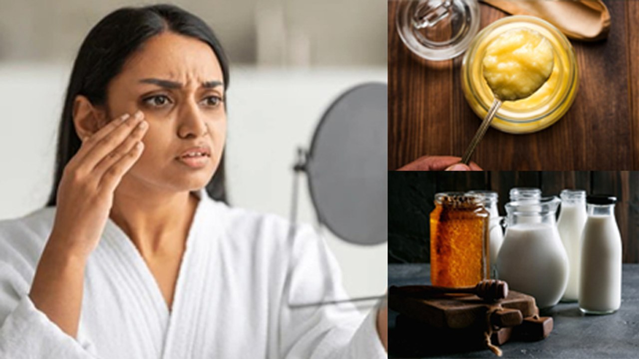 Dry Skin Hone Par Kya Kare, Dry Skin Me Kya Lagana Chahiye | Boldsky