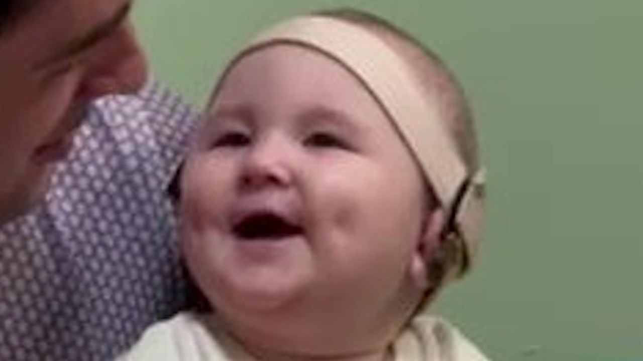 Baby born completely deaf hears his parents' voices for the first time
