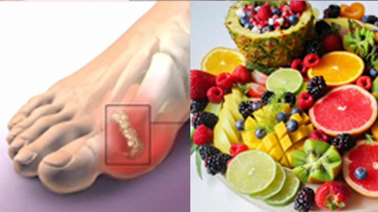 High Uric Acid Me Konsa Fal Khana Chahiye | Can We Eat Vitamin C Fruits In Uric Acid | Boldsky