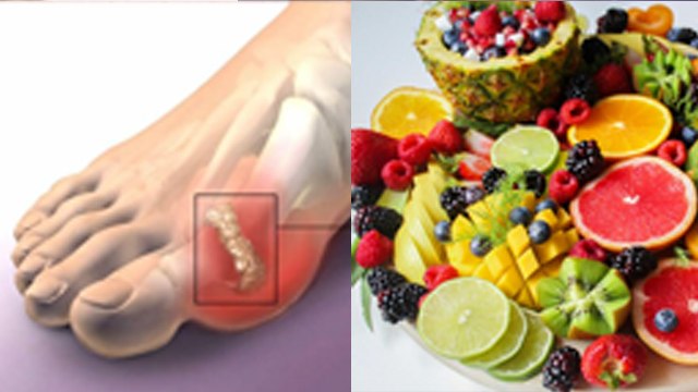 High Uric Acid Me Konsa Fal Khana Chahiye | Can We Eat Vitamin C Fruits In Uric Acid | Boldsky