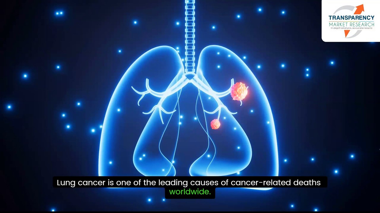 Lung Cancer Diagnostics Market