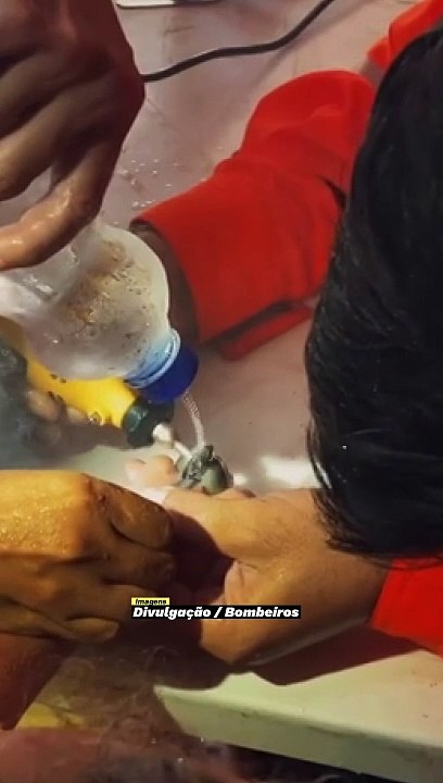 Criança prende peça de aço no dedo e bombeiros levam uma hora para remover