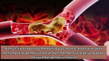 Penyebab dan Gejala Kolesterol Tinggi yang Perlu Diketahui awas jangan sampai menyesal