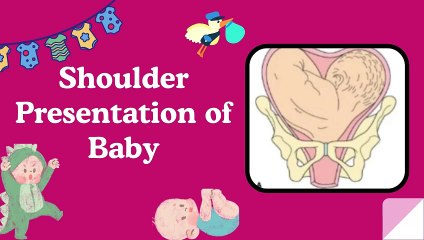 Shoulder Presentation of Baby in Pregnancy Explained | Transverse Lie of Baby #pregnancyeducation