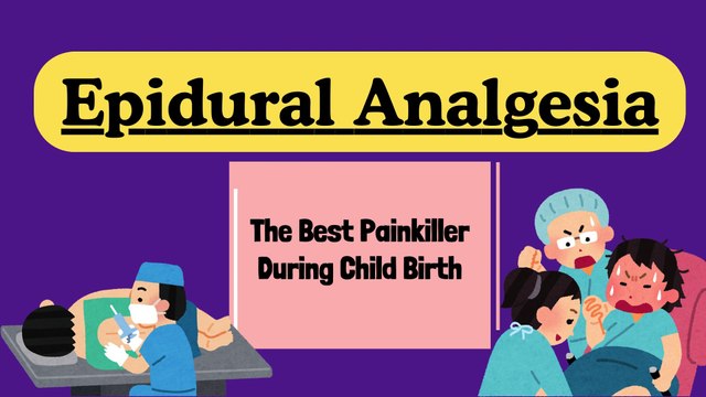 Epidural Anesthesia & Spinal Anesthesia | Regional Anesthesia for painful delivery of baby
