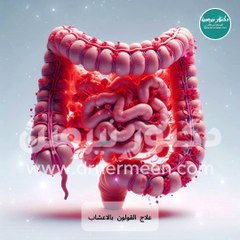 علاج القولون بالاعشاب #قولون #قولون_عصبي #علاج #القولون #القولون_العصبي #اعشاب
