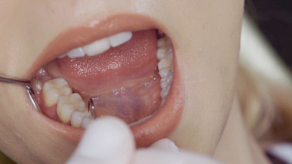 8/9 years waiting list for NHS dentist?: Why are waiting lists so long?