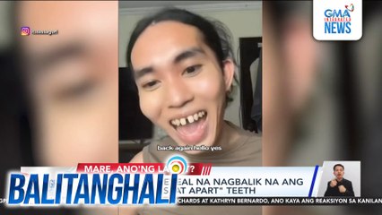 Sassa Gurl, ni-reveal na nagbalik na ang kaniyang "one-seat apart" teeth | Balitanghali