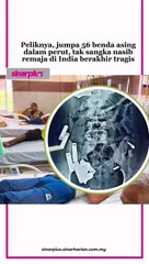 Peliknya, macam mana boleh telan benda tajam tanpa rasa sakit? Tengok foto pun dah seram