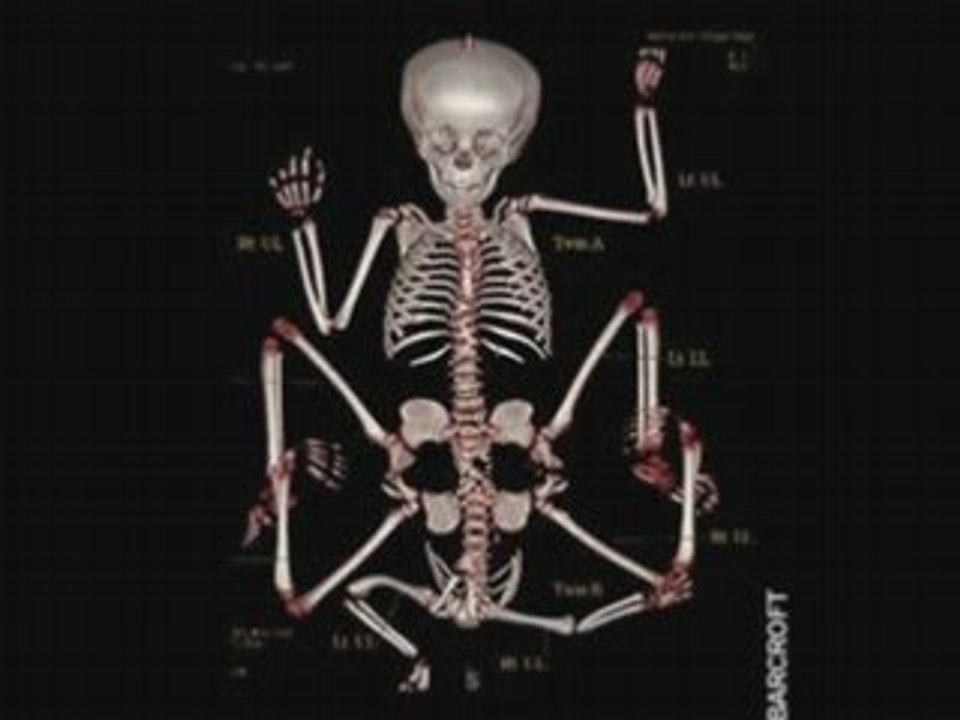 strange X-ray's