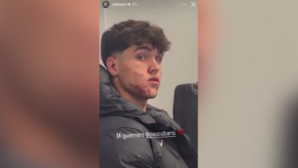 Da miedo verlo: así ha quedado la cara de Cubarsí