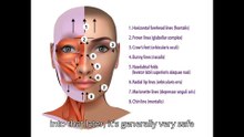 "botox explained: benefits, risks, costs, and what to expect before your first treatment"