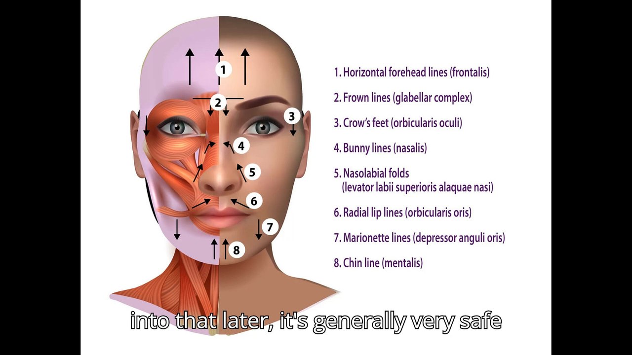 "botox explained: benefits, risks, costs, and what to expect before your first treatment"