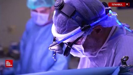 Cezayirli yapışık ikizler Türkiye'de yapılan operasyonla ayrıldı