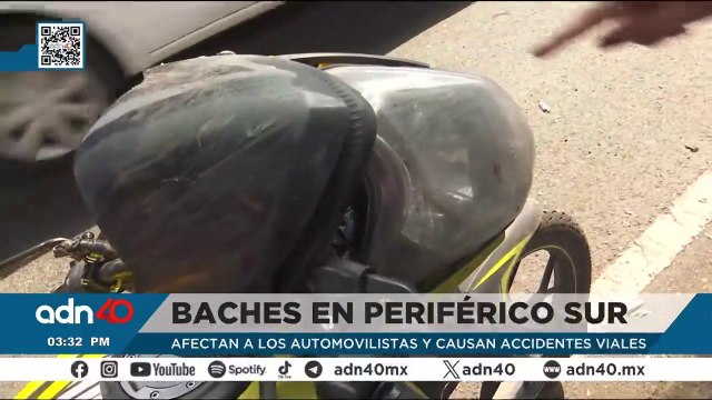 El pequeño Christopher ya fue operado tras el fuerte choque en Ecatepec