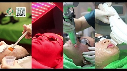 Nặn mụn có tốt không? Khi nào nên nặn mụn?