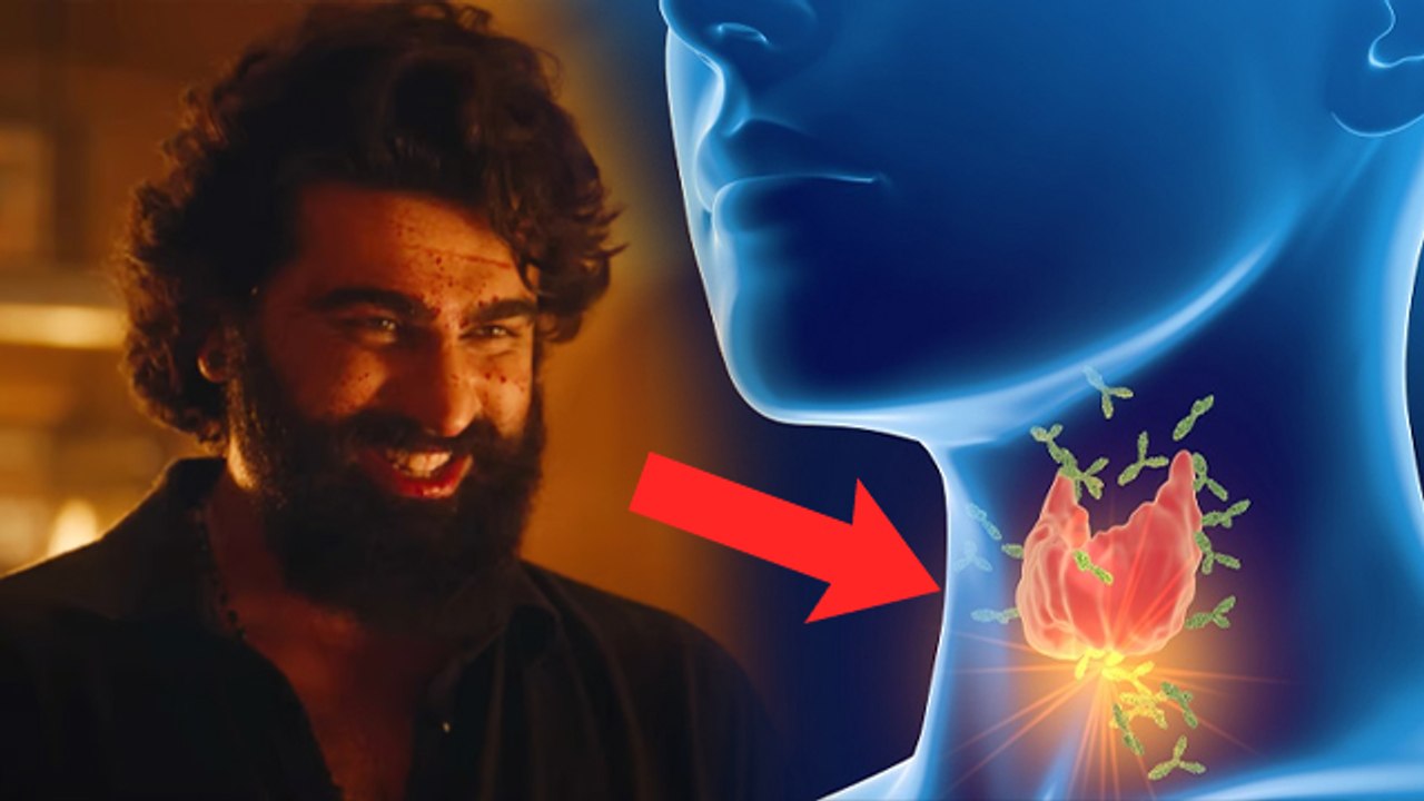 Arjun Kapoor Suffering From Hashimoto Thyroiditis, Causes, Symptoms, Treatment In Hindi | Boldsky