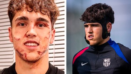 Barcelona: Cubarsí se entrena con máscara para proteger su herida de la cara