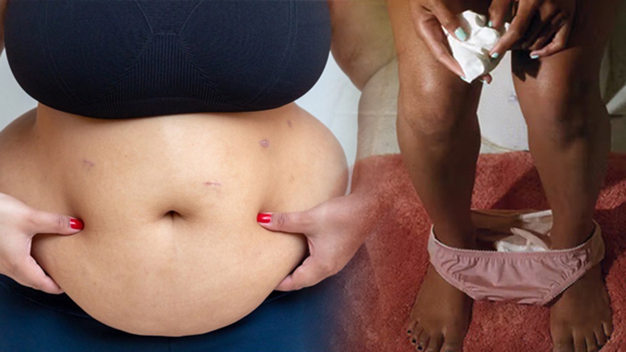 Kya Sirf Mote Logo Ko PCOS PCOD Hota Hai | Do Only Overweight Women Get PCOS, FACT CHECK...