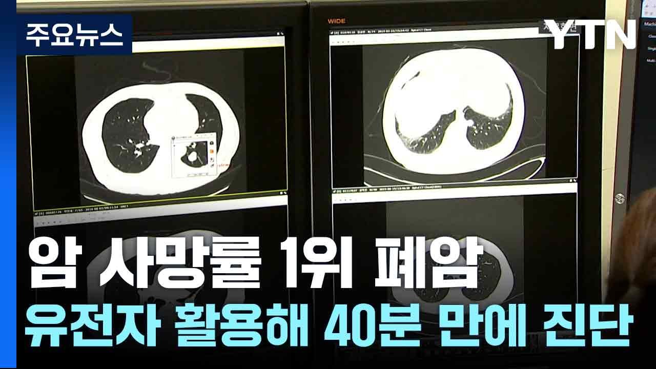 암 사망률 1위 폐암...유전자 가위 활용해 40분 만에 진단 / YTN