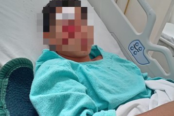 Brutal persecución policial deja a menor al borde de la muerte en Bucerías
