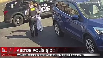 ABD'li polisin saldırdığı kemik kanseri hastanın boynu kırıldı