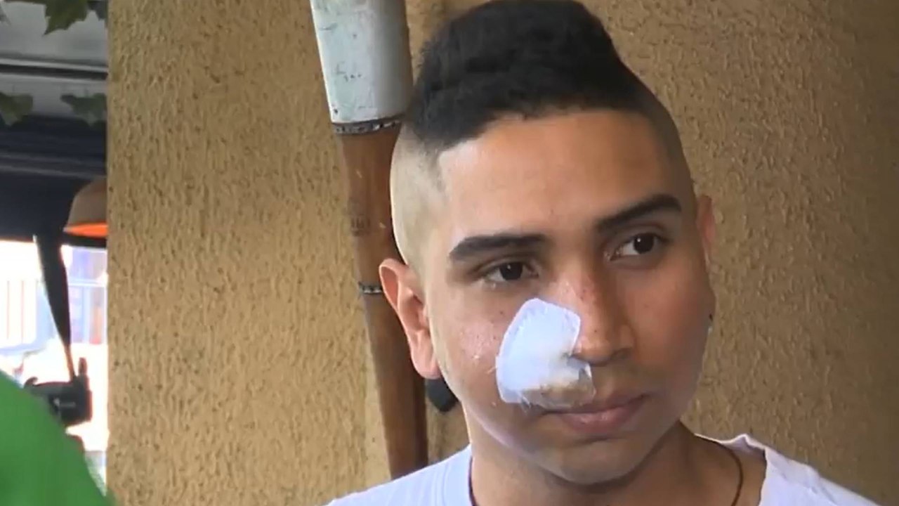 Comerciante resultó gravemente herido en el rostro tras oponerse a robo en Medellín