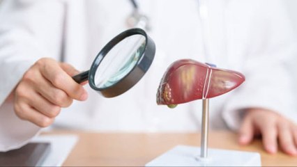 Grasa En El Hígado: La Enfermedad Silenciosa Que Afecta A Millones